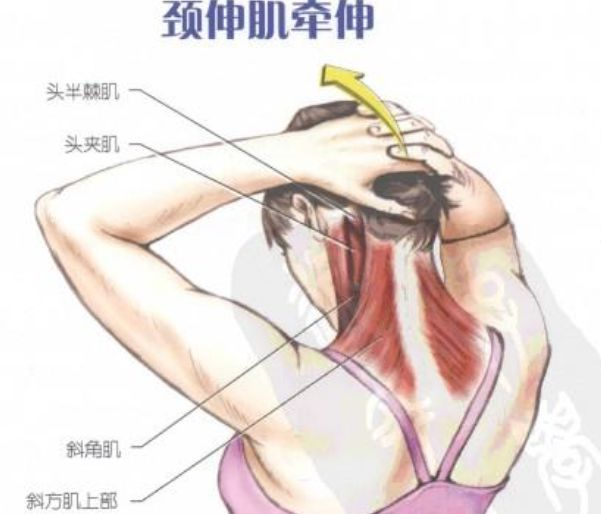 颈伸肌牵伸: 坐或站位,两手交叉放置于后脑顶部附近,轻轻将头部垂直