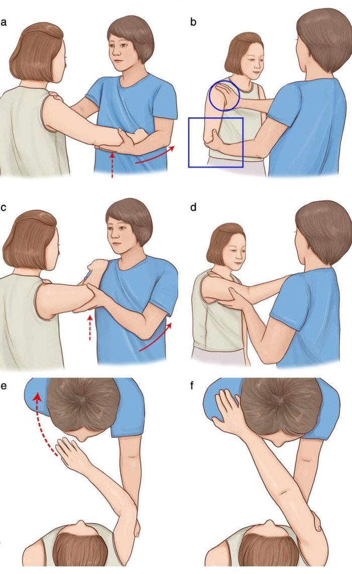 什么是肩关节前向脱位按摩放松肌肉的cunningham法和sool法复位技术