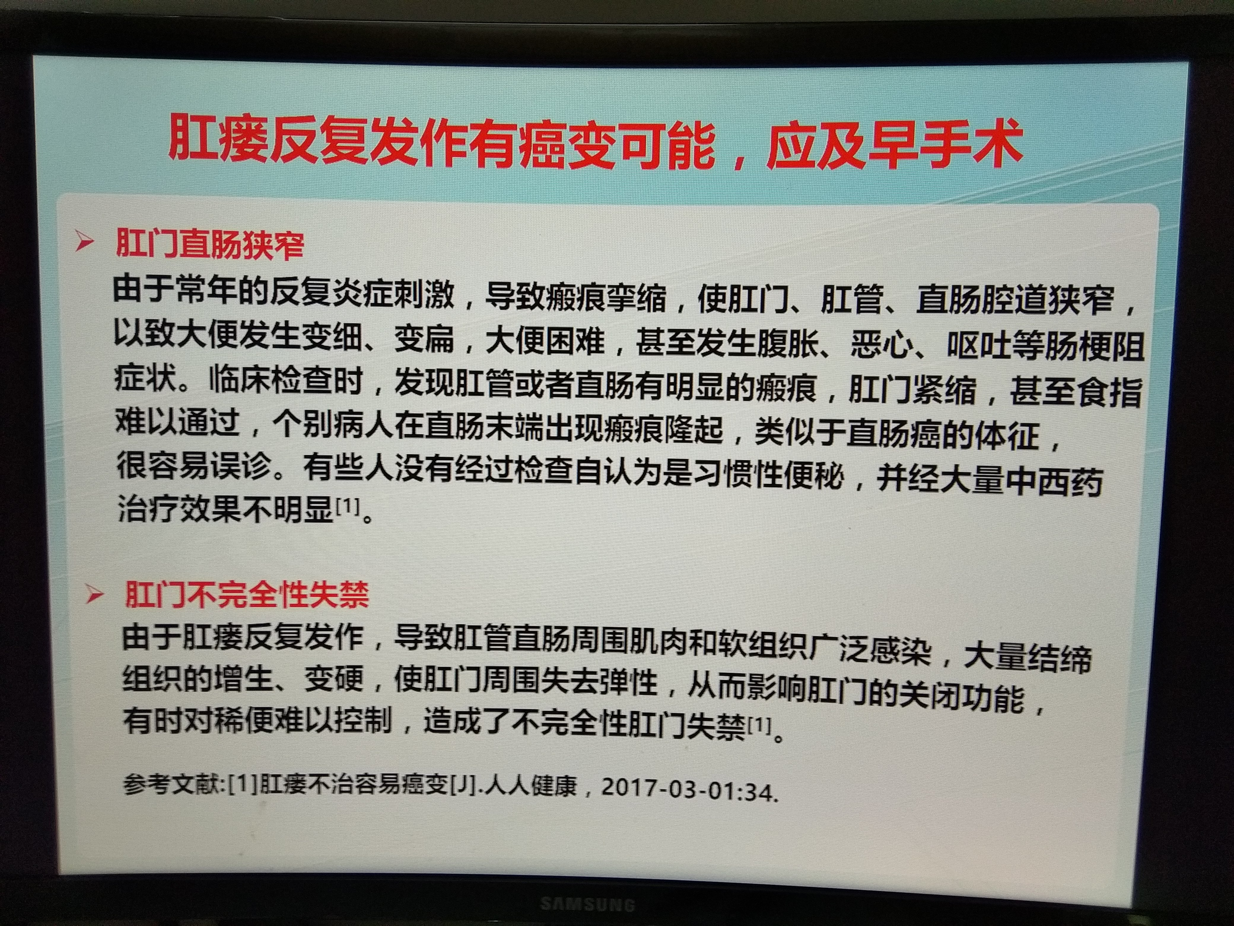 肛瘘反复发作有癌变可能应及早手术