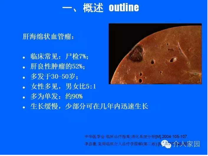 肝脏海绵状血管瘤-基础与介入