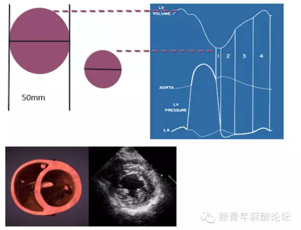 围术期经食管超声心动图监测操作的专家共识:tee标准化切