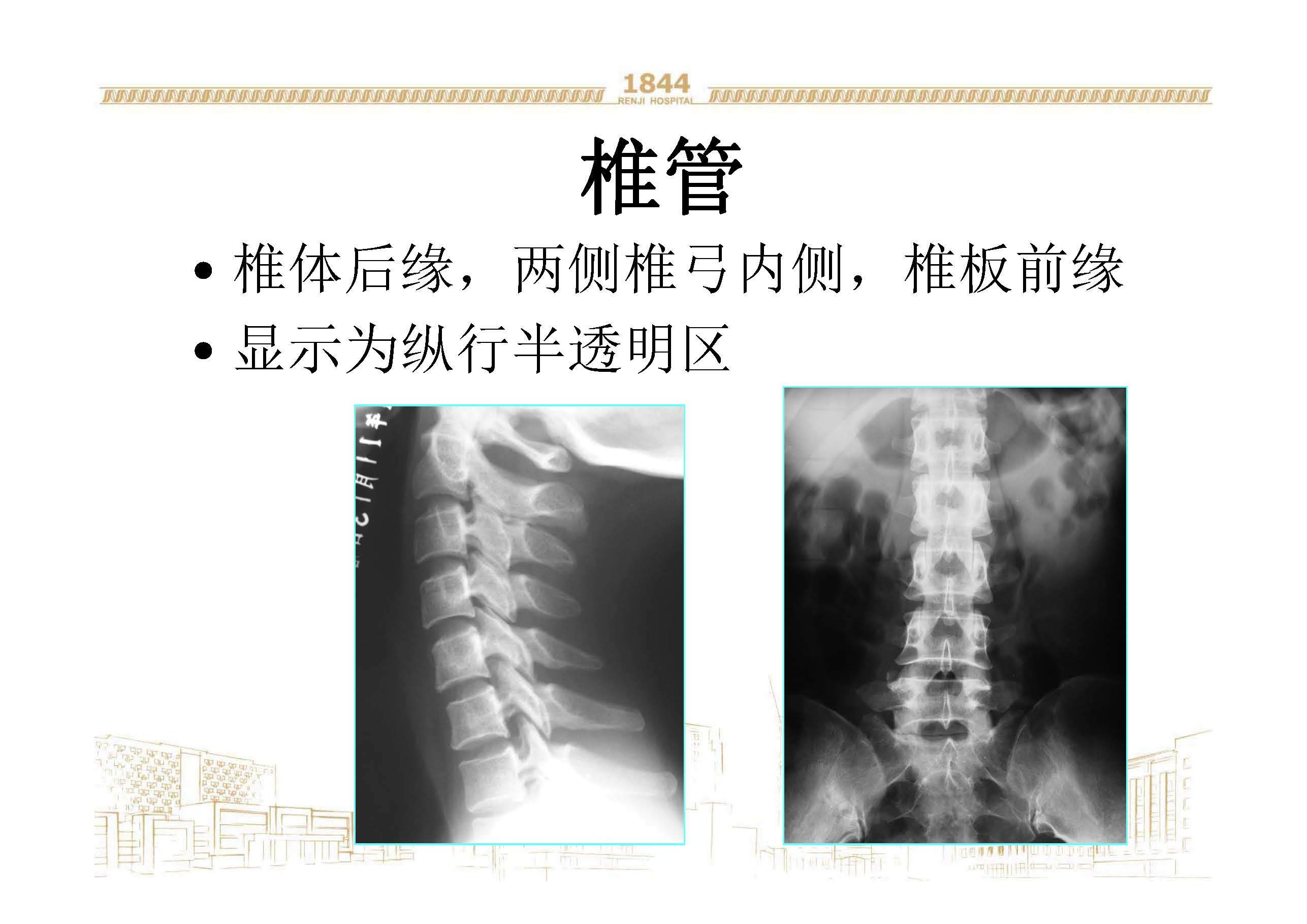 已引起人们的广泛关注,脊柱骨关节退行性变极为常见,尤其是在活动度较