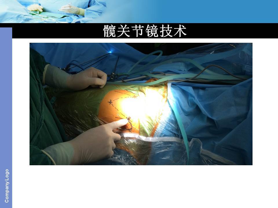 保髋手术基础入门篇