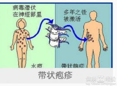 小小银针神奇祛痛