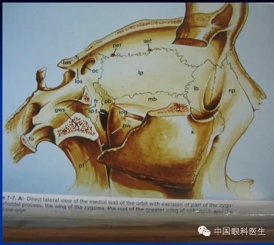 眼眶的解剖最全面的图文详解