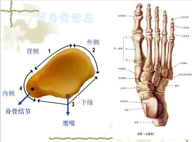 怎么才能发现看到足副舟骨呢?