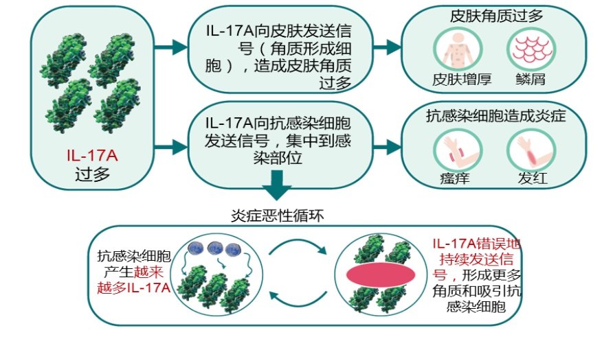 生物制剂il17a抑制剂治疗中重度银屑病