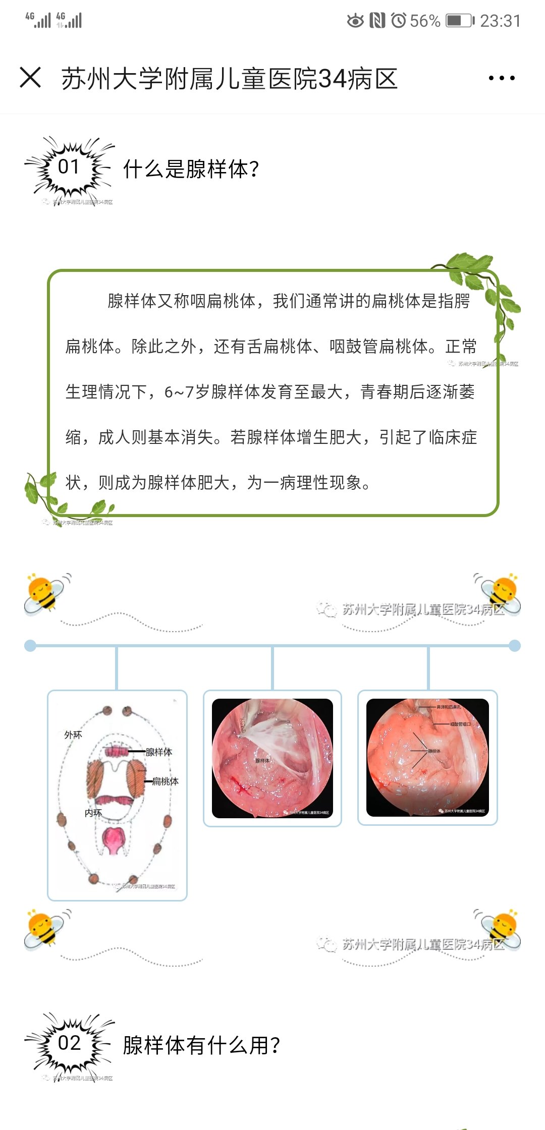 腺样体肥大扁桃体肥大阻塞性睡眠呼吸暂停低通气综合征鼾症