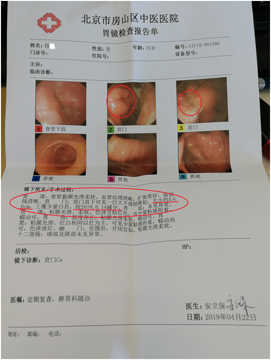 第2张图片是胃镜活检的病理报告.