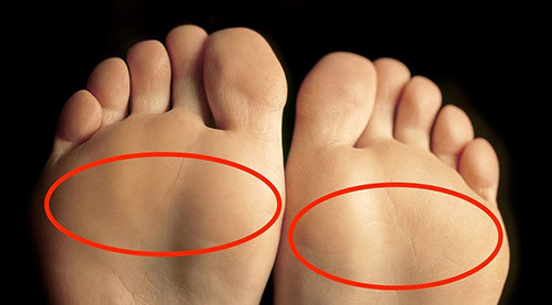 前脚掌痛是怎么回事跖痛症