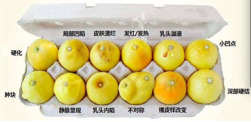 医生,我会不会是乳腺癌啊?