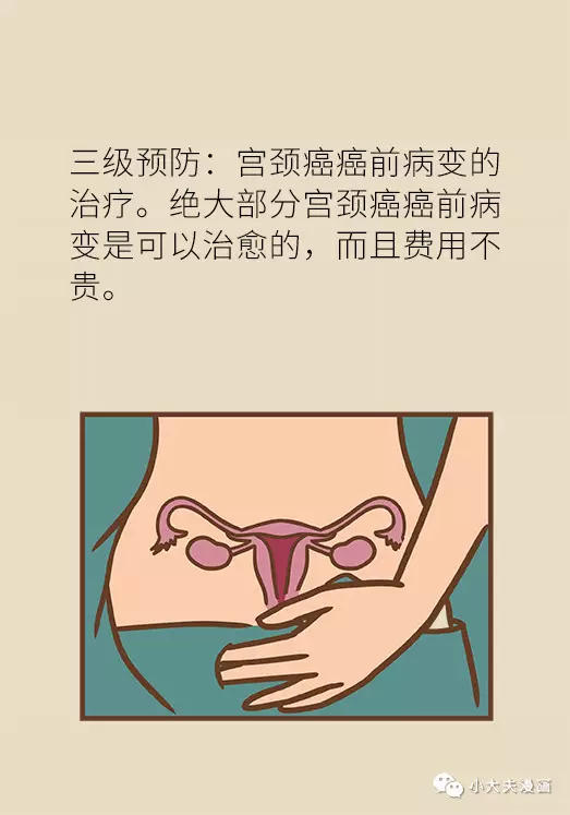 34岁月经异常,一年后竟确诊宫颈癌晚期?
