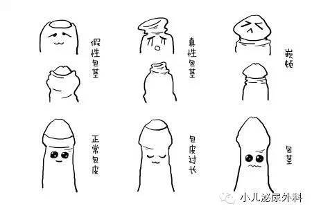 科普一下什么是儿童的包皮过长,包茎