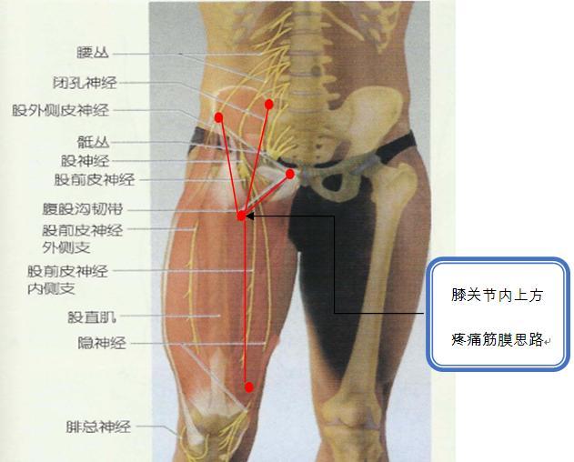 膝关节内上方疼痛思路.jpg