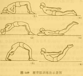 飞燕式腰背肌肉功能锻炼