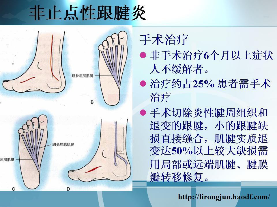 讓我們認識跟痛症4