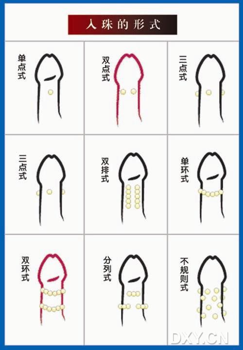 近年来,阴茎入珠术作为一种新的产物在男人们中间流行