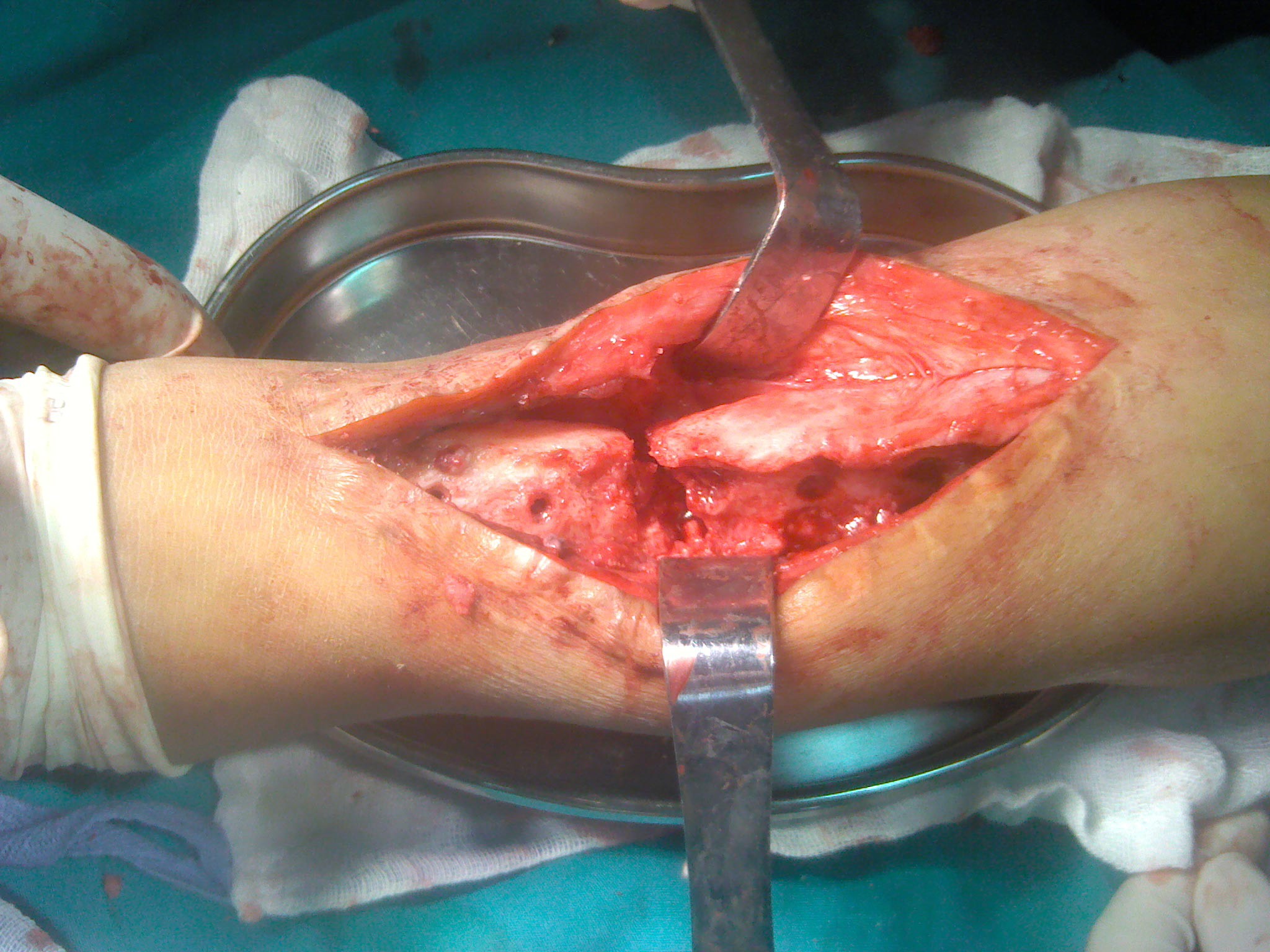 搜索 按医院找医生 按疾病找医生 首页 疾病知识 下载客户端 好大夫