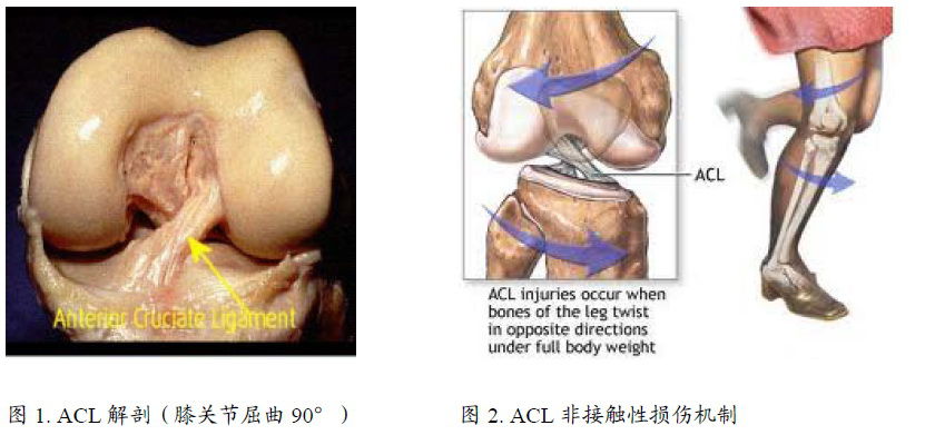 前交叉韧带损伤科普 感谢北医三院马勇撰写 好大夫在线