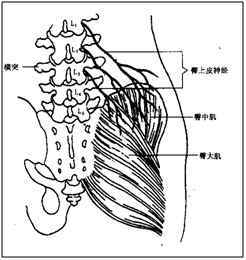 臀上皮神经定位图图片