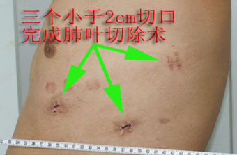 包含朝陽醫院北醫三院、全程透明收費掛號號販子聯系方式專業代運作住院的詞條 包含朝陽醫院北醫三院、全程透明收費掛號號販子聯系方式專業代運作住院的詞條