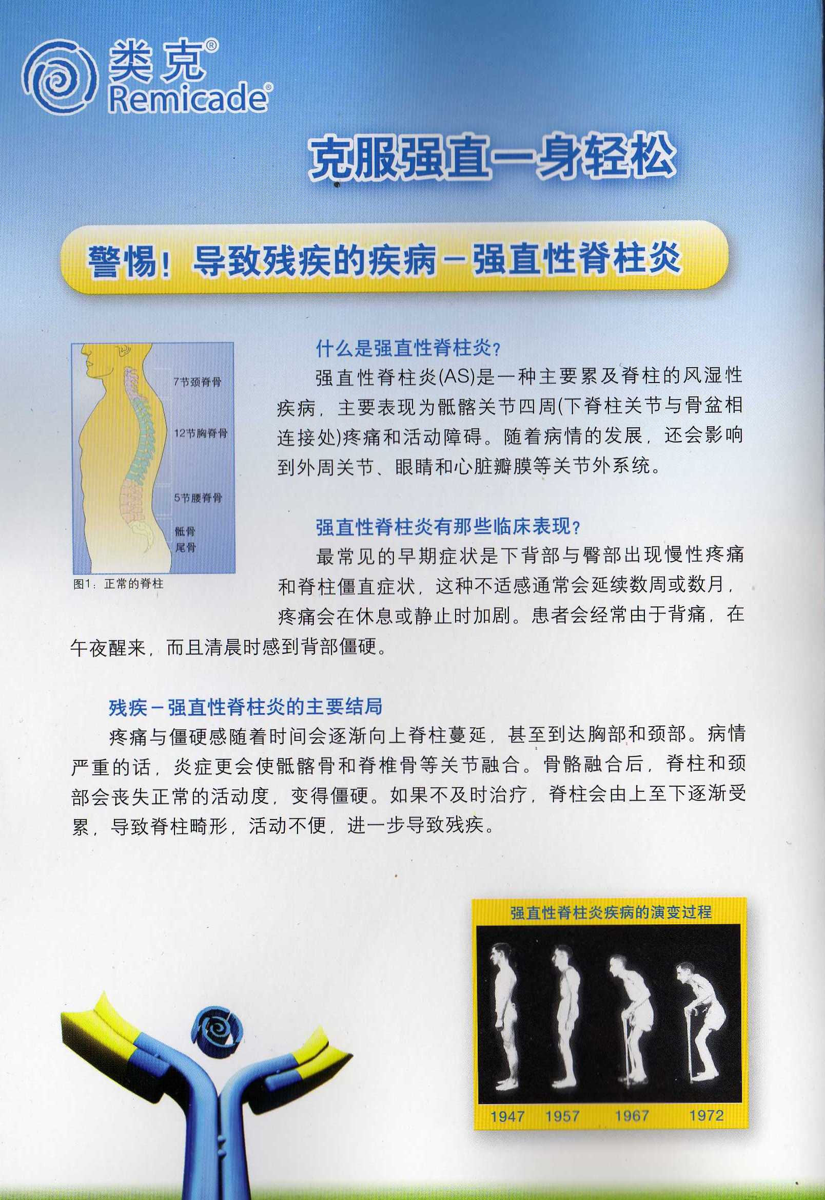 类克(英夫利希单抗)治疗强直性脊柱炎简介 - 好大夫在线