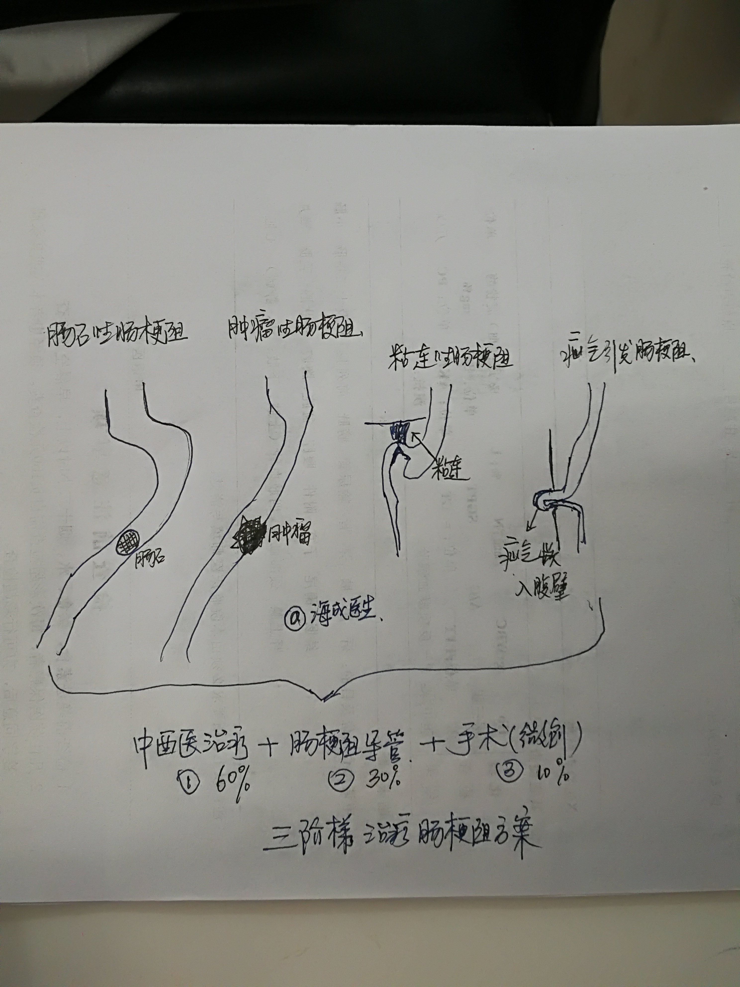 图解各种各样的肠梗阻