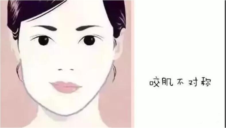 发现自己左右脸不对称,该怎么办啊? - 好大夫在线
