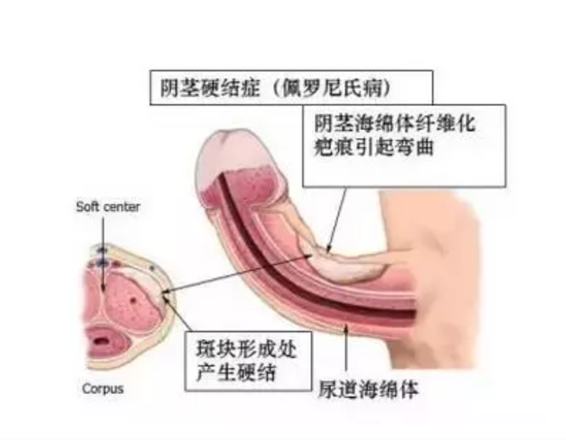 圖文圖片