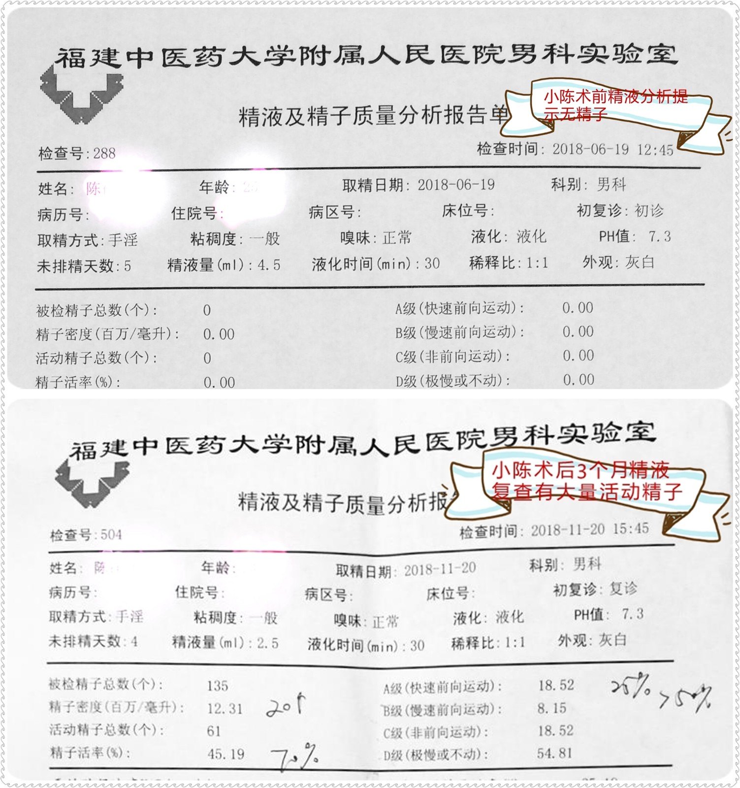 小陳術後檢測到精子的視頻小陳術後3個月檢測到精子的圖像2018年11月