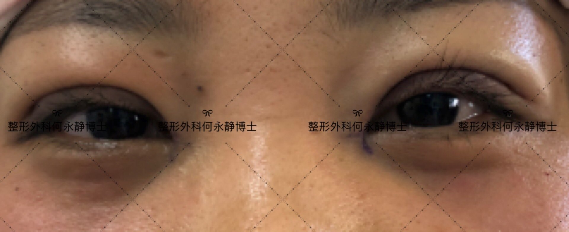 暂无