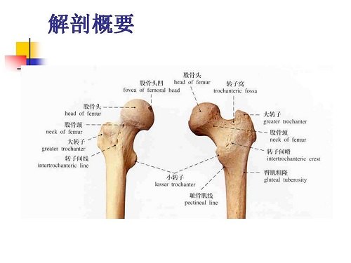 股骨颈骨折临床表现及治疗