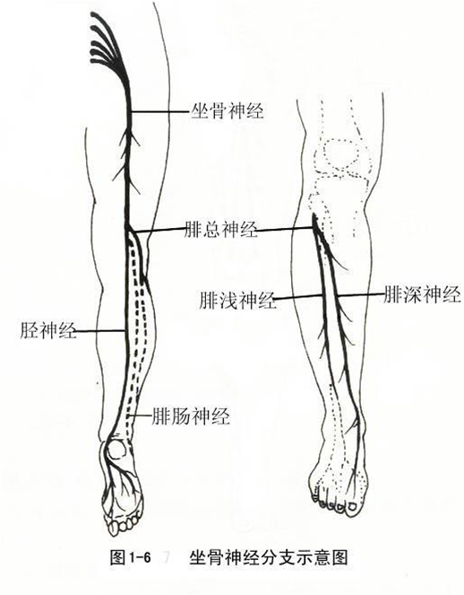 梨状肌综合症