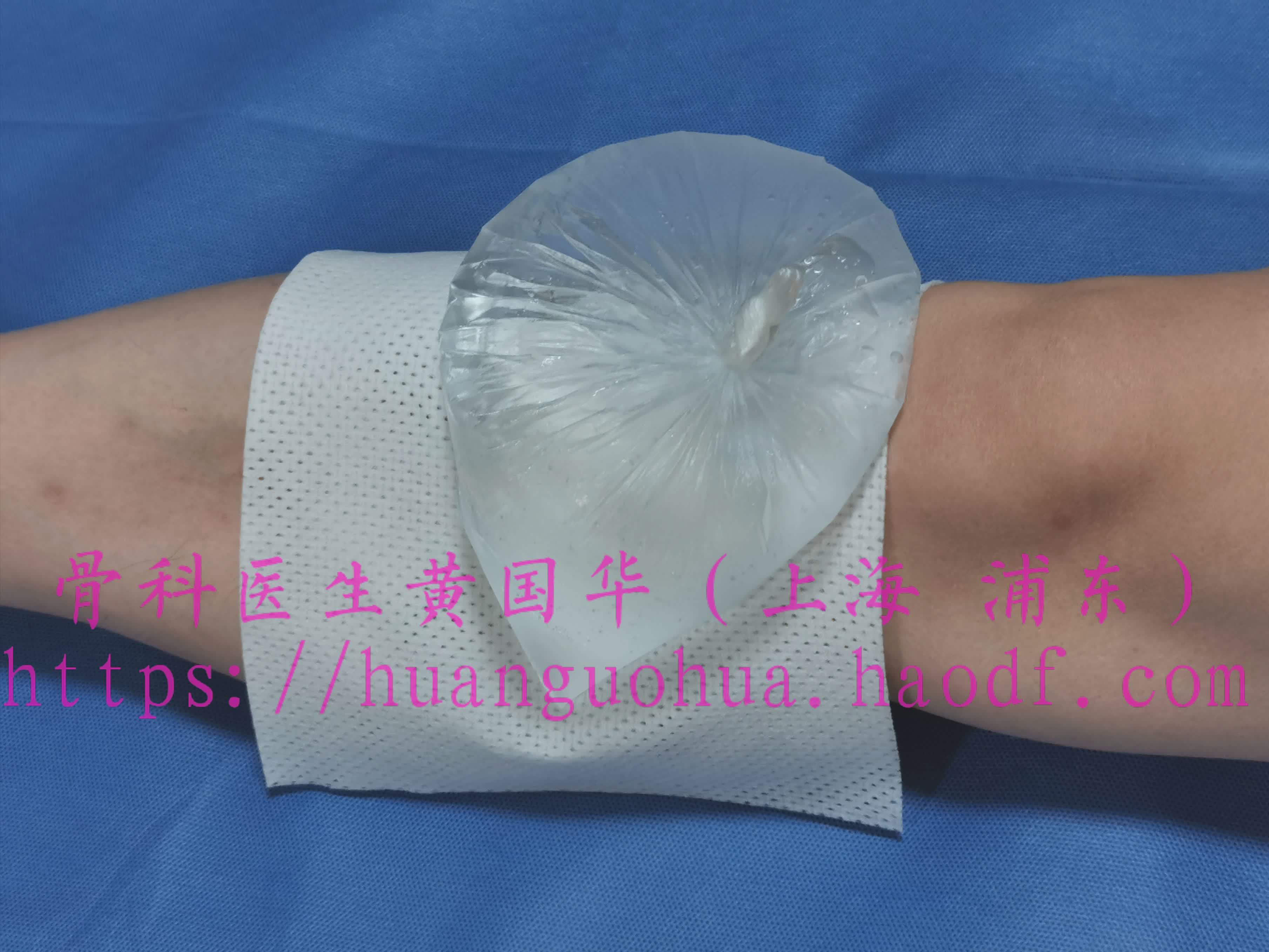 如何自制冰袋冷敷_运动创伤_运动创伤日常护理 - 好大夫在线