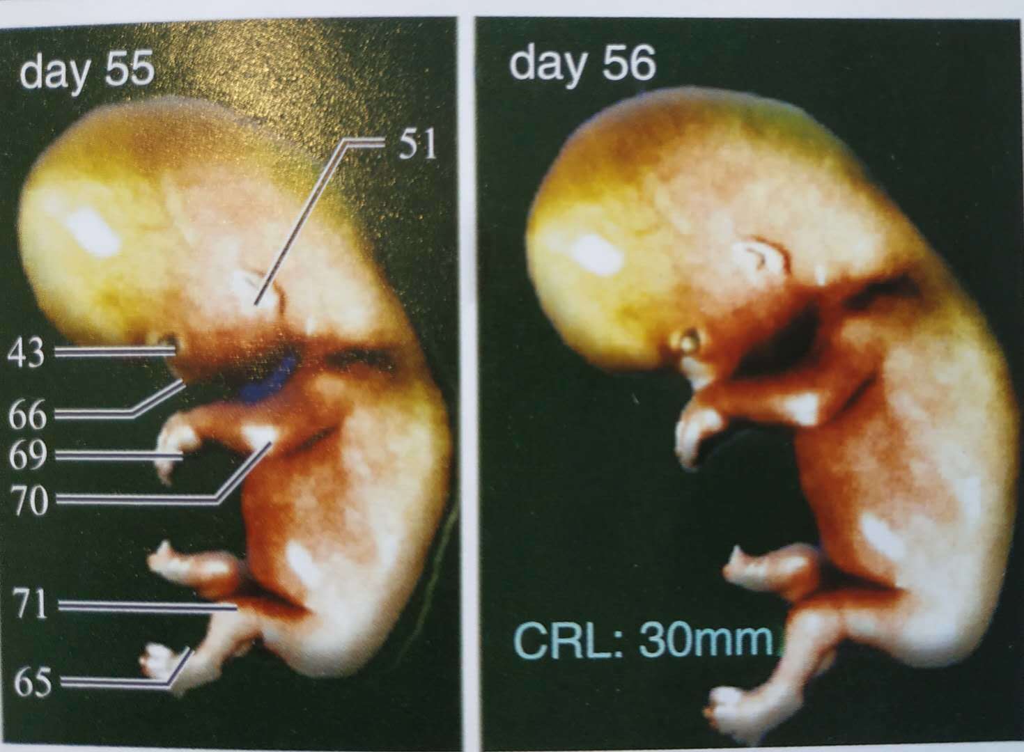 crl是胎儿的什么图片