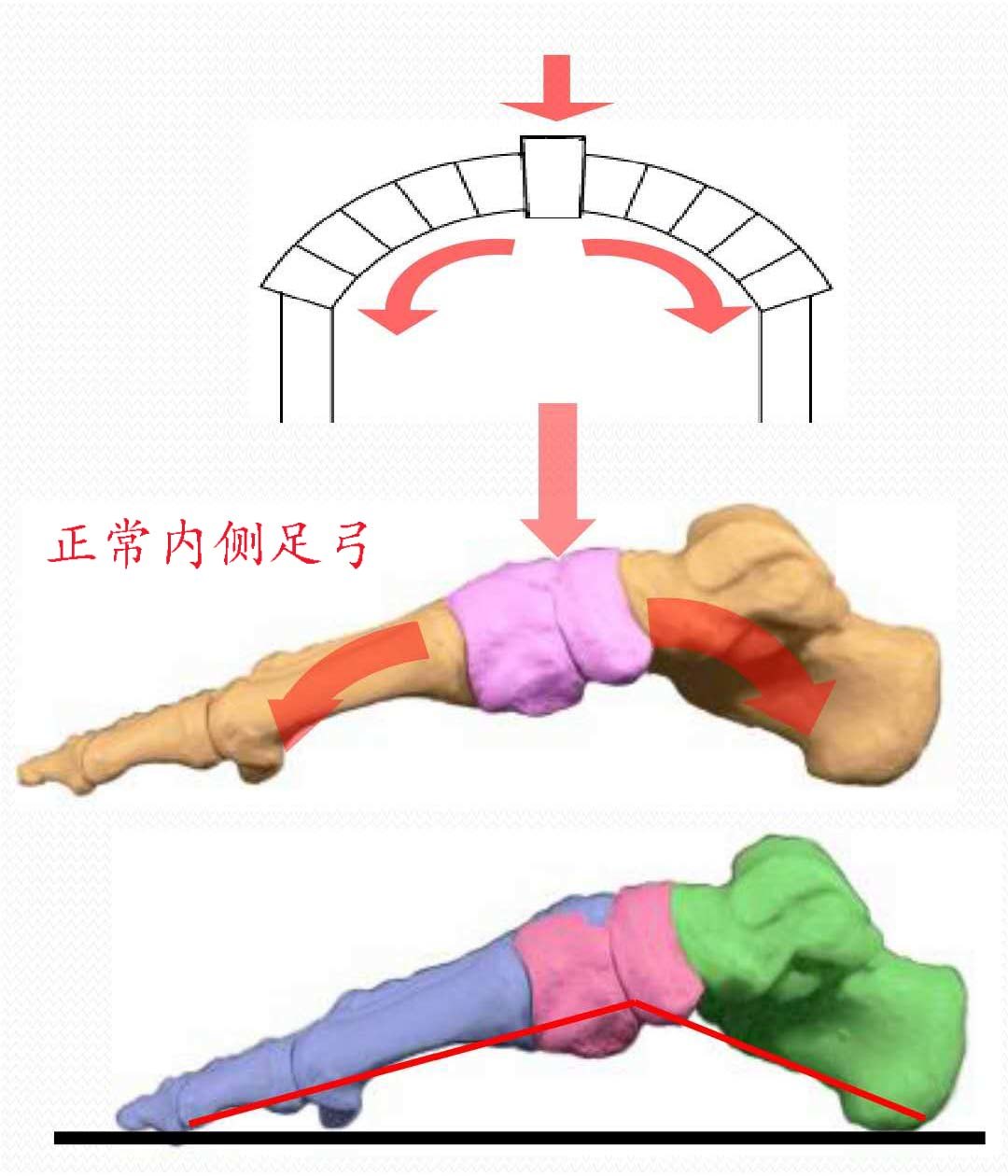 兒骨科普兒童扁平足