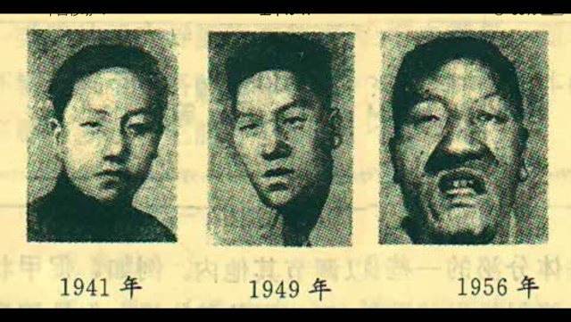 肢端肥大症图片 - 好大夫在线