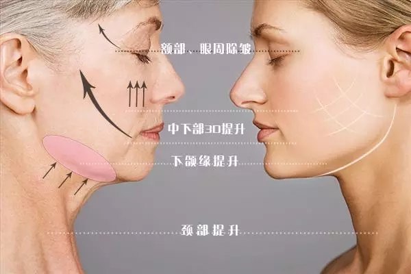 wYYBAFyZwfWAThCHAACN47Y-kEU277.jpg?_ms_=493d