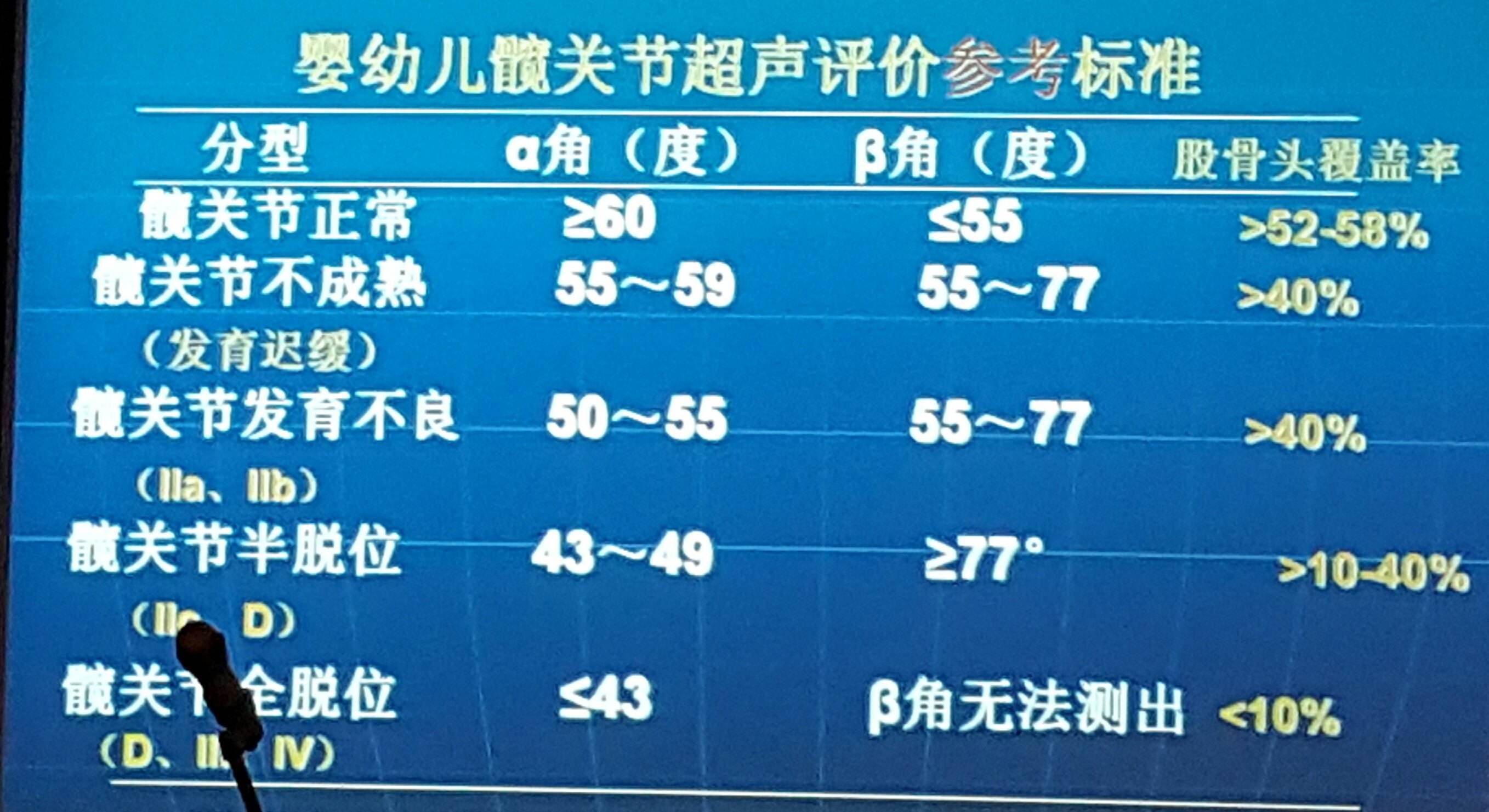 先天性髋关节脱位