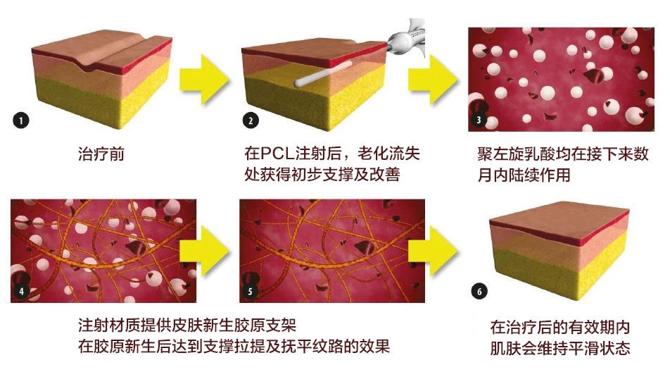 十大童颜针品牌