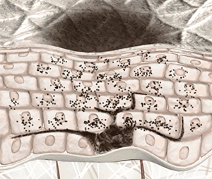 斑是有潜伏期的? - 好大夫在线