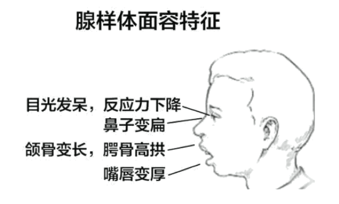 急性上呼吸道感染最常见的病因 woYBAFyPRh6AH3WTAAIHqnHAfBc097.png?_ms_=84fb