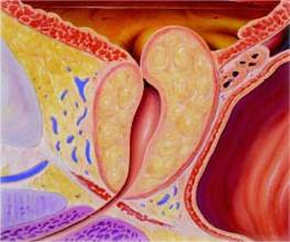 尿道损伤狭窄的原因与治疗_尿道损伤_病因_治疗方法_发病原因_治疗