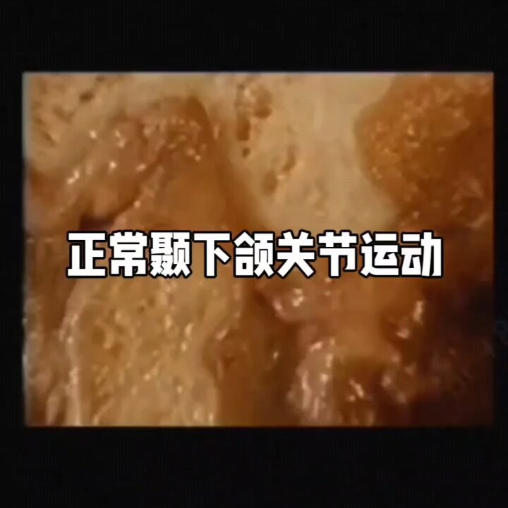 默认图片