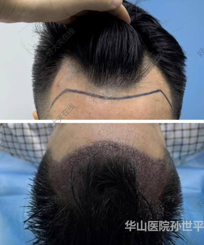 圖文圖片