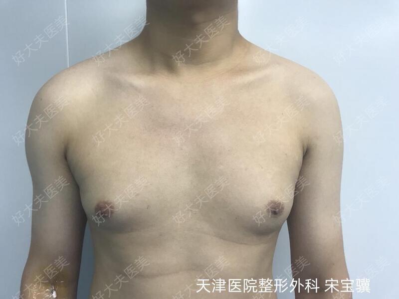 圖文圖片