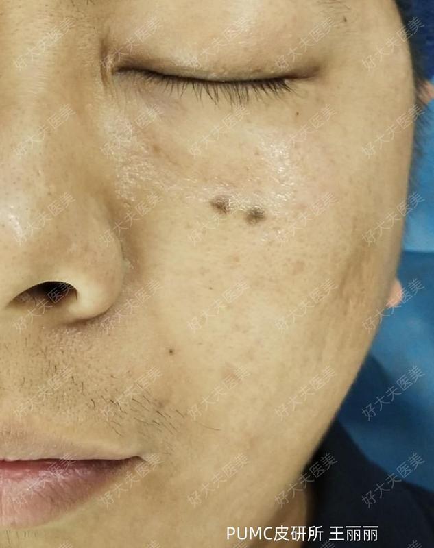 圖文圖片