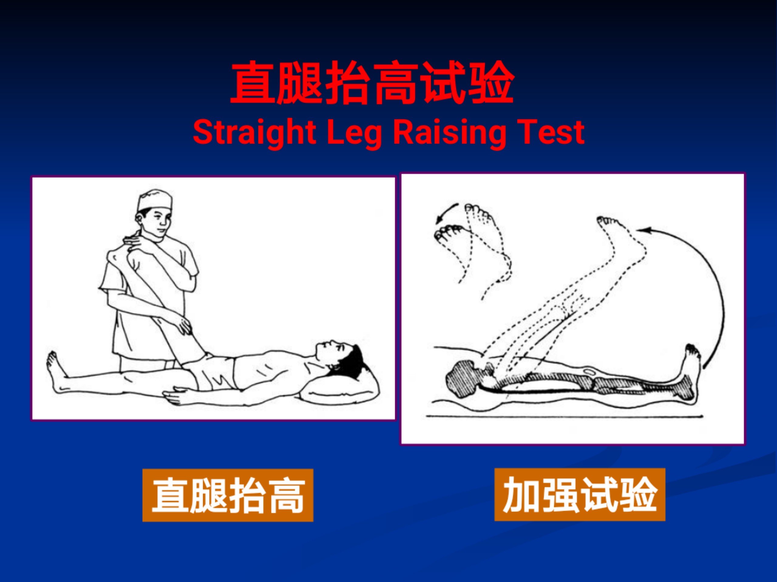 浅谈腰痛(1)_27.jpg