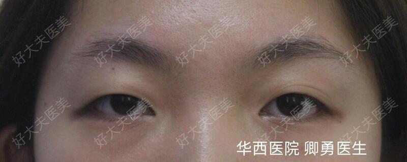 圖文圖片