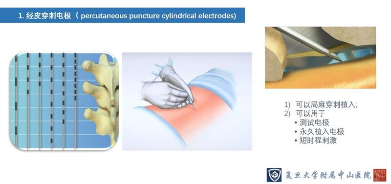 外科电极1.jpg
